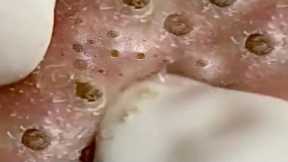 𝑭𝒓𝒐𝒎 𝑺𝒓𝒆𝒔𝒔𝒆𝒅 𝒕𝒐 𝑺𝒆𝒓𝒆𝒏𝒆 : 𝑯𝒐𝒘 𝒂 𝑹𝒆𝒍𝒂𝒙𝒊𝒏𝒈 𝑺𝒌𝒊𝒏𝒄𝒂𝒓𝒆 𝑹𝒐𝒖𝒕𝒊𝒏𝒆 𝑪𝒂𝒍𝒎𝒔 𝒀𝒐𝒖𝒓 𝑴𝒊𝒏𝒅 𝑨𝒏𝒅 𝑺𝒐𝒖𝒍 #946493